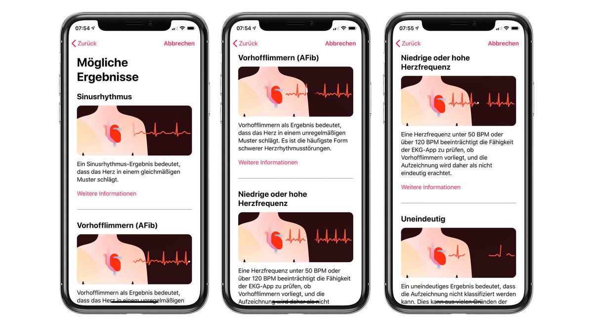 Apple ekg watch app deals