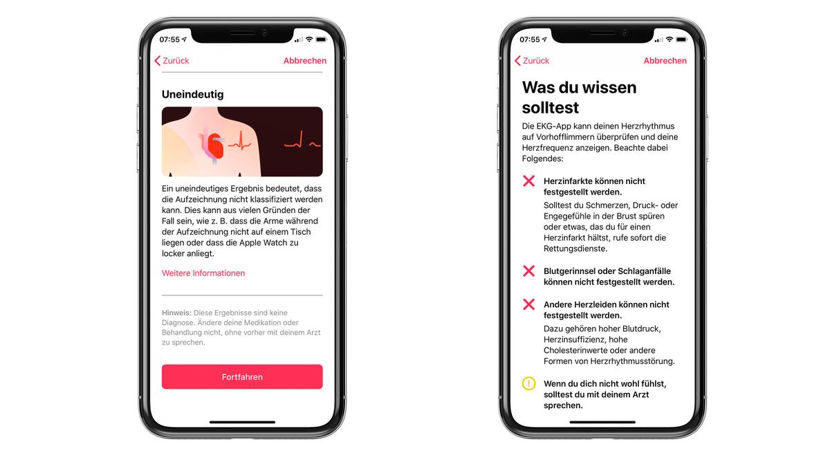 Apple Watch 4 EKG einrichten So geht s Mac Life