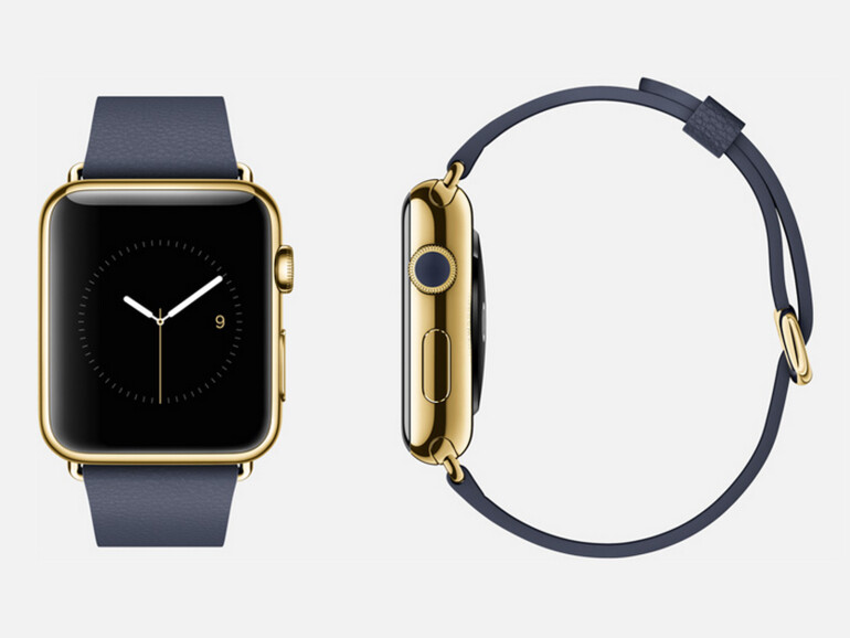 Die Farbe der Krone spiegelt die Farbe des Armbandes wieder