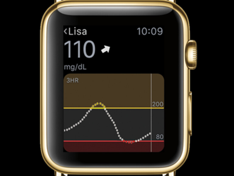 Blutzucker-Kontrolle per Apple Watch