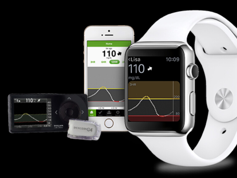 Blutzucker-Kontrolle per Apple Watch