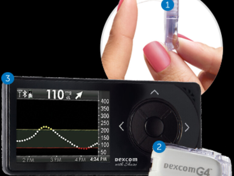 Blutzucker-Kontrolle per Apple Watch