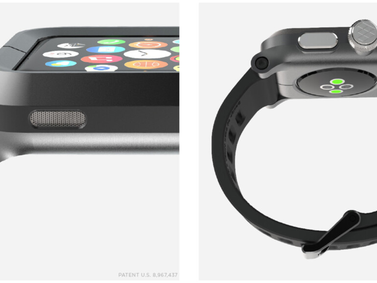 Das Epik Apple Watch Kit bietet einen Vollschutz für die Apple Watch