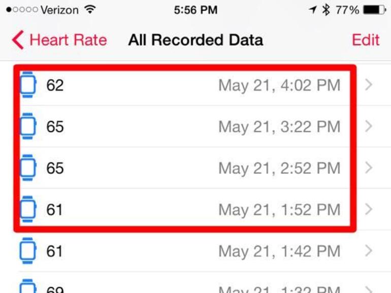 Eigentlich soll die Apple Watch die Herzfrequenz des Trägers der Uhr alle 10 Minuten überprüfen