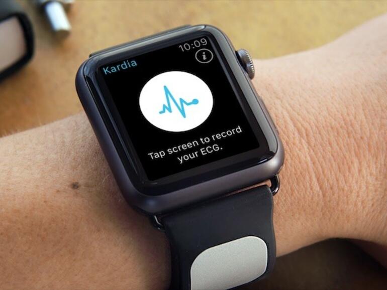 AliveCor Kardia Band