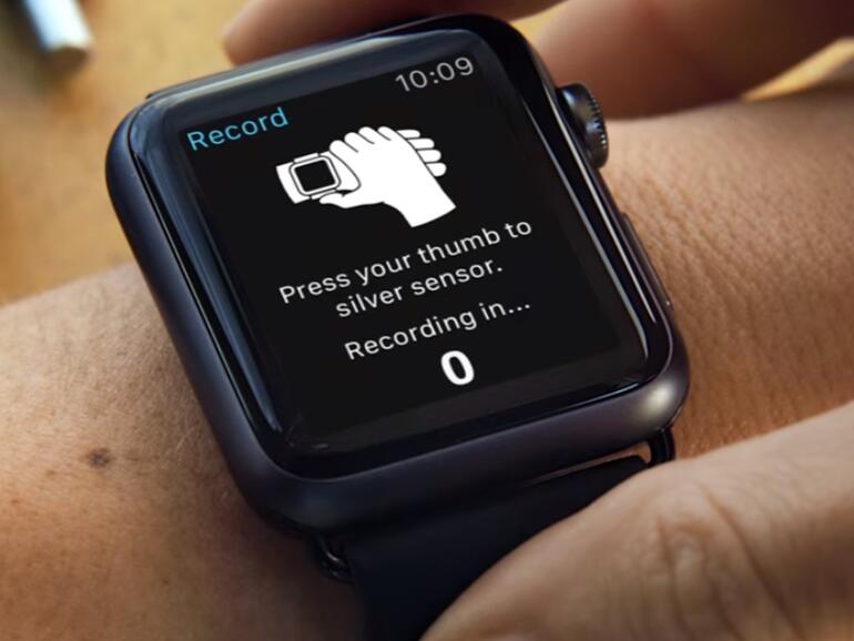 AliveCor Kardia Band