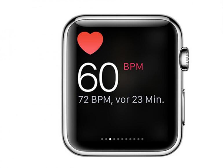 Ein extrem hoher Puls von über 200 veranlasste einen Kanadier, die Rettung zu rufen - gemessen hatte er ihn auf der Apple Watch