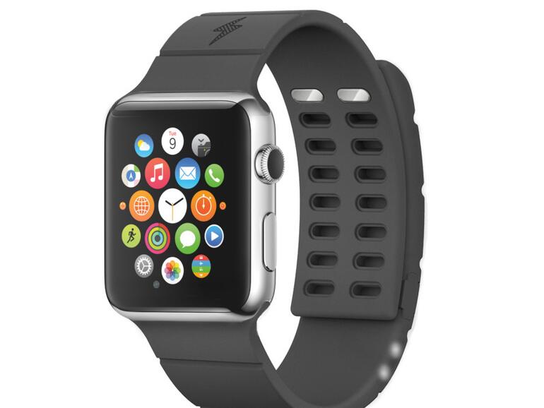 watchOS 2.0.1 verhindert Akku-Armbänder - vorerst