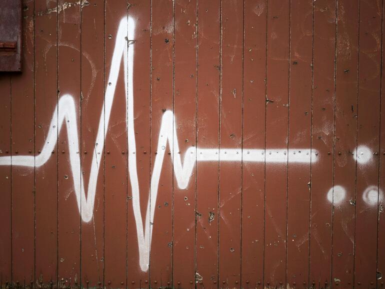 EKG bald in der Apple Watch?