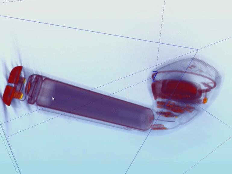 AirPods in der Computertomographie