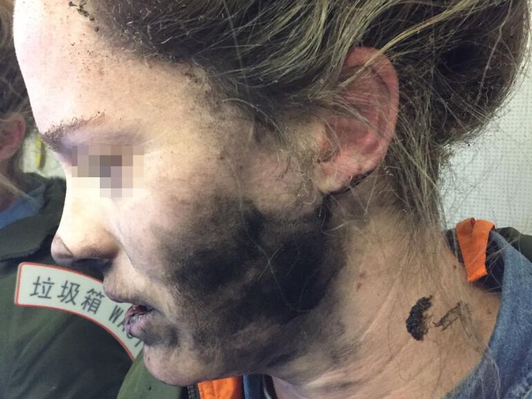 Das Brandopfer kurz nach dem Ereignis