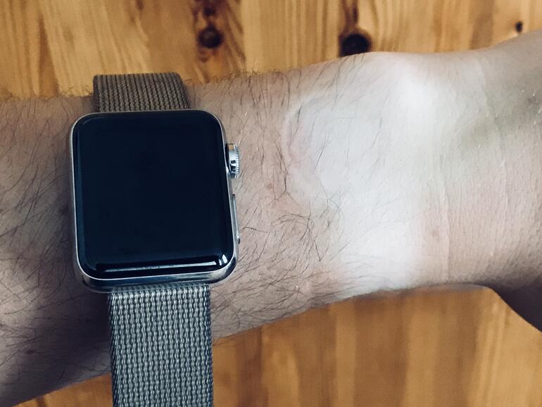 Streifenfrei braun sieht anders aus