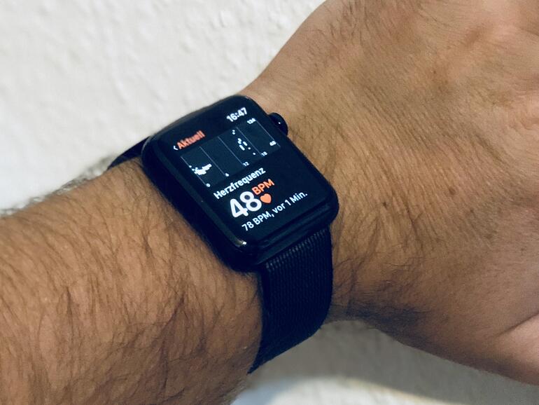 Die Apple Watch kann offenbar Schlafapnoe und Bluthochdruck nachweisen