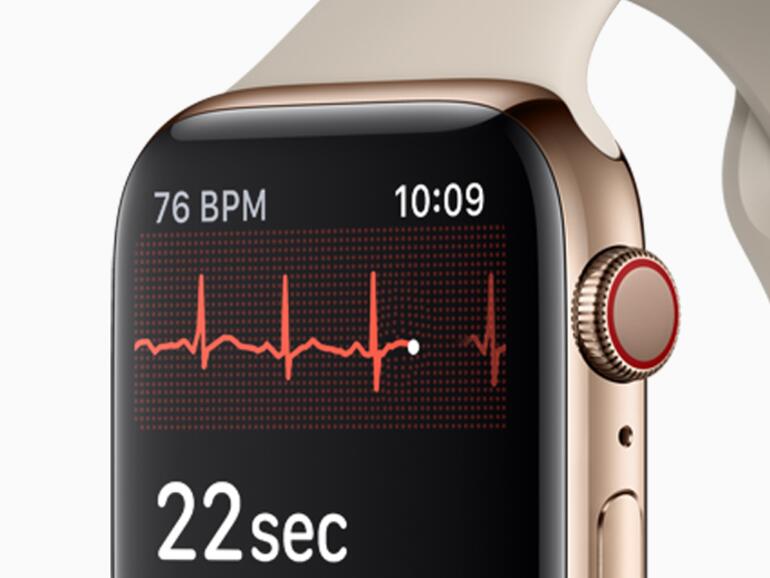 Elektrischer Sensor auf der Unterseite und Finger auf der digitalen Krone erlauben ein EKG