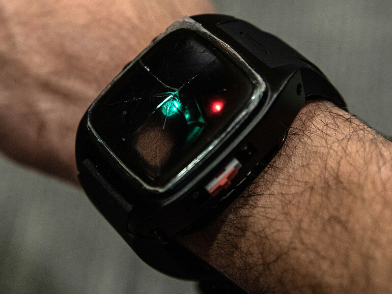 HopeBand zeigt Opiatmissbrauch an