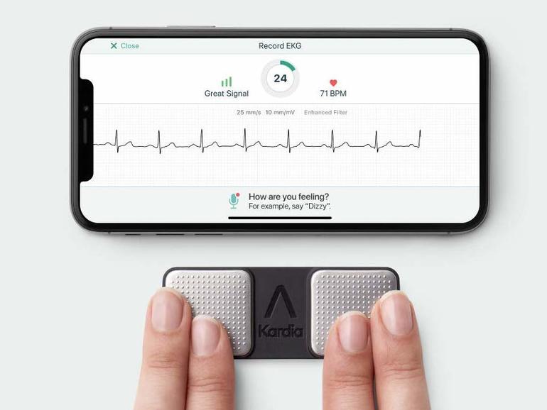 ekg monitor apple watch