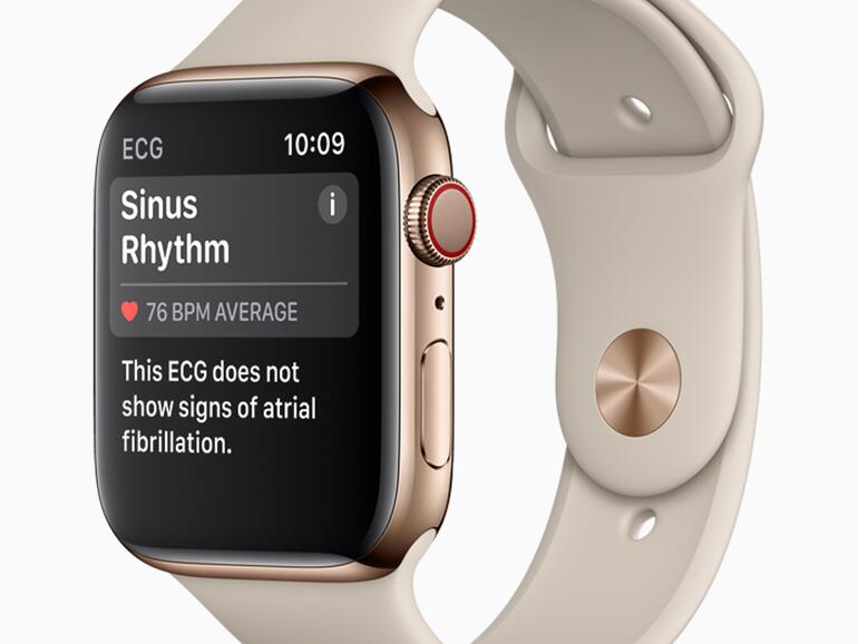 Die Apple Watch erkennt Vorhofflimmern