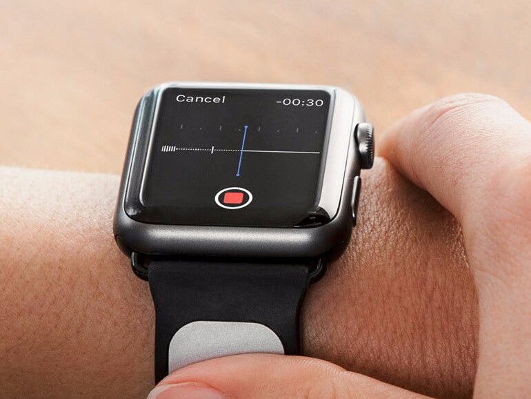 Apple Watch mit Alivecor-Armband
