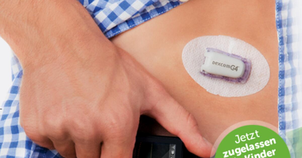 Apple Watch soll Blutzucker messen können Mac Life