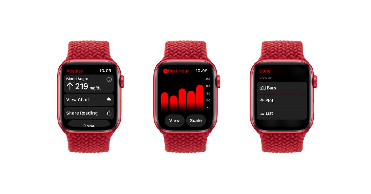 Apple Watch 7: So könnte sie Blutzucker messen | Mac Life