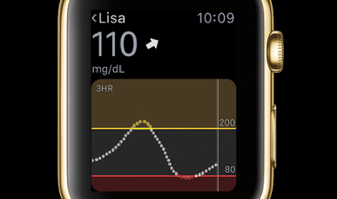 Blutzucker-Kontrolle per Apple Watch