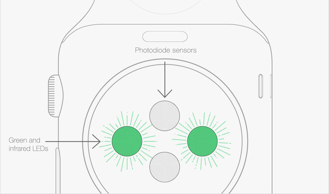 Apple schlägt auch einen Workaround vor, der zumindest bei sportlichen Aktivitäten sehr nützlich sein kann