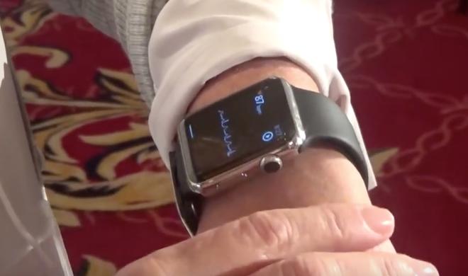 Prototyp des Apple Watch EKG von AliveCor