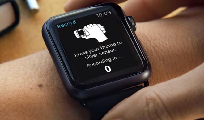 AliveCor Kardia Band