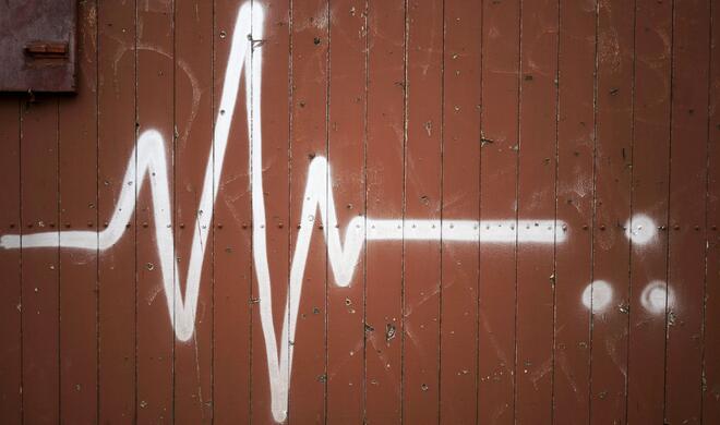 EKG bald in der Apple Watch?