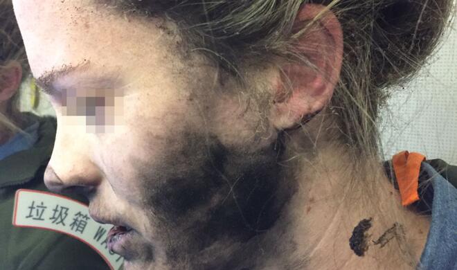 Das Brandopfer kurz nach dem Ereignis