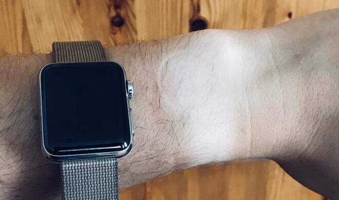 Streifenfrei braun sieht anders aus