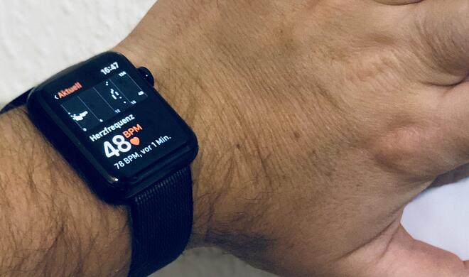 Die Apple Watch kann offenbar Schlafapnoe und Bluthochdruck nachweisen