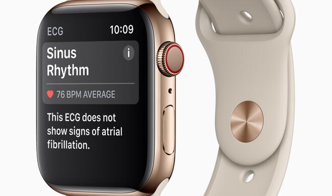 Die Apple Watch erkennt Vorhofflimmern