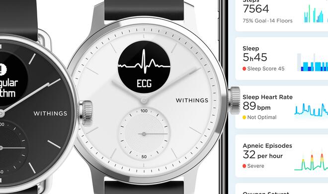 withings smartwatch ecg