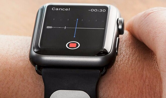 Apple Watch mit Alivecor-Armband