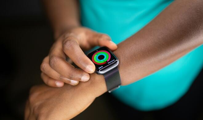 Apple Watch am Handgelenk? Wie langweilig: Ein neuer Trend findet andere Orte,